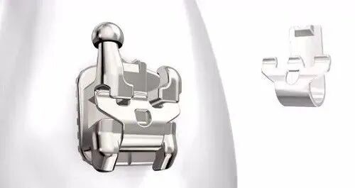 正畸颊面管是什么牙齿矫正，一根弓丝是怎么“工作”的？_https://www.jmylbn.com_新闻资讯_第2张