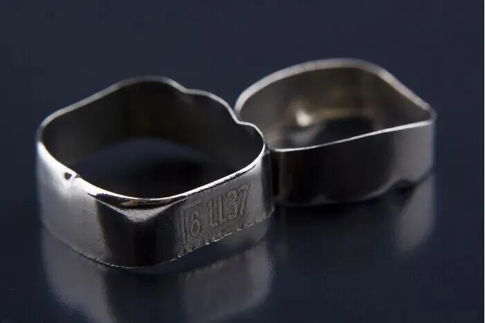 正畸颊面管是什么牙齿矫正，一根弓丝是怎么“工作”的？_https://www.jmylbn.com_新闻资讯_第4张