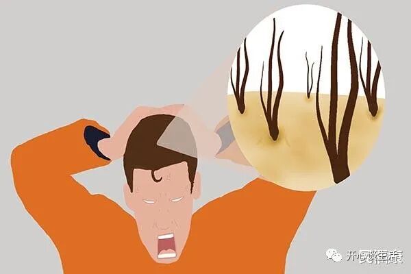 头皮上出现的“小疙瘩”是什么？对身体健康有影响吗？本文告诉你