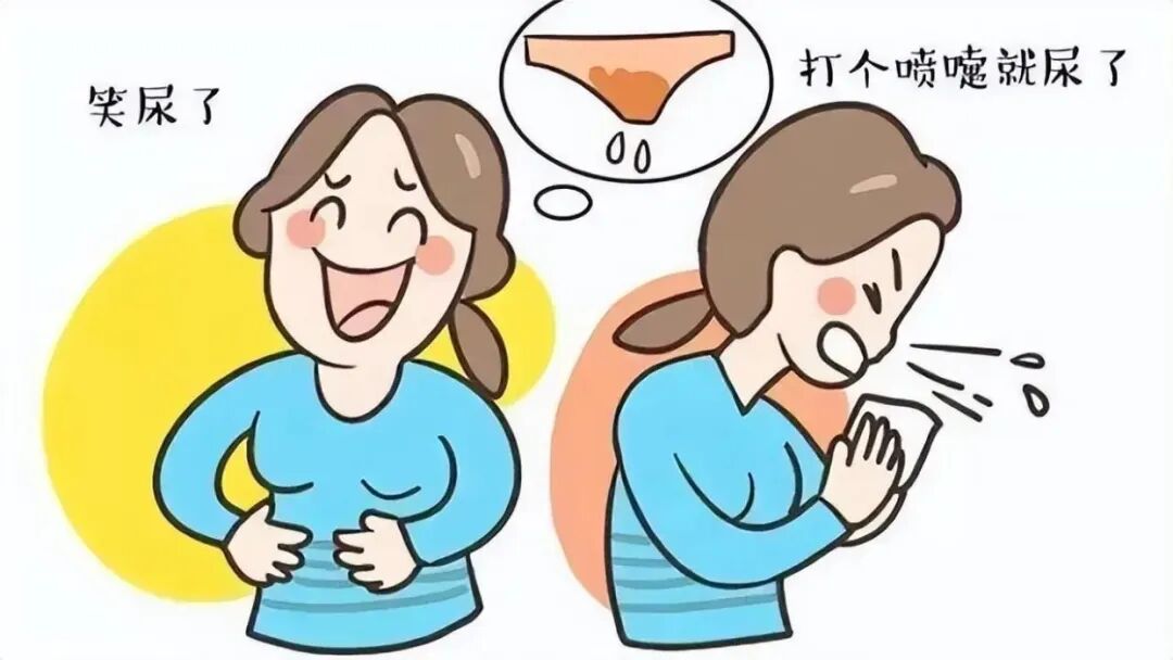 尿道张力过强怎么办【全州首例】黔西南州人民医院成功开展尿失禁“经闭孔无张力尿道悬吊术”_https://www.jmylbn.com_新闻资讯_第6张