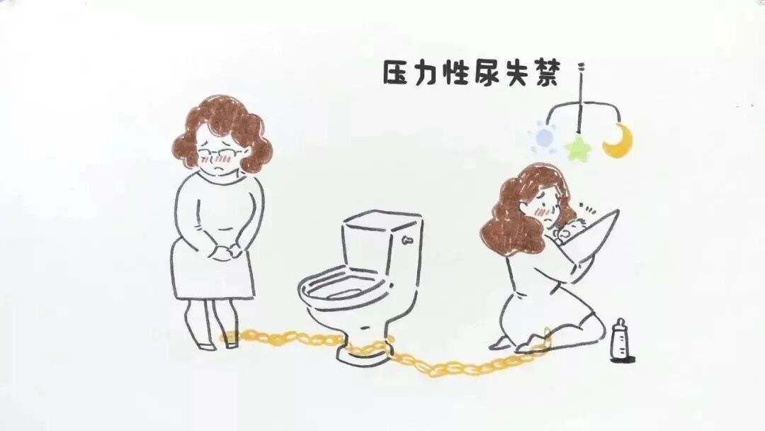 尿道张力过强怎么办【全州首例】黔西南州人民医院成功开展尿失禁“经闭孔无张力尿道悬吊术”_https://www.jmylbn.com_新闻资讯_第4张