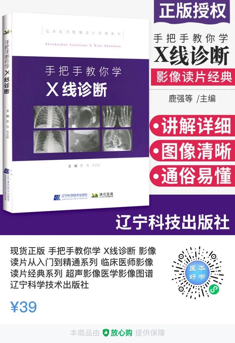 DR胶片为什么分尺寸借DR成像原理详解胸部正位摄片技术参数_https://www.jmylbn.com_新闻资讯_第12张