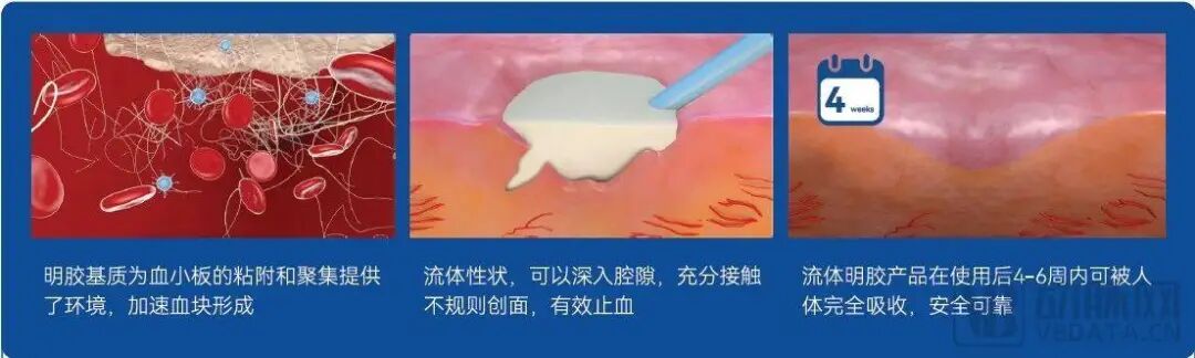 止血微球怎么用今晚直播 ｜ 博恩锐尔：国产首款自主研发可吸收止血流体明胶【动脉严选新品鉴第74期】_https://www.jmylbn.com_新闻资讯_第2张