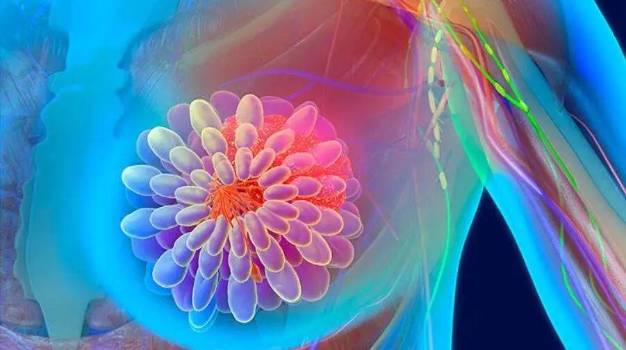 FISH怎么诊断CTC【SE-i·FISH-CTC超早期肿瘤筛查】年年体检却查出晚期癌症！90%的人防癌筛查都做错了​！_https://www.jmylbn.com_新闻资讯_第8张