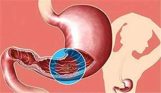 FISH怎么诊断CTC【SE-i·FISH-CTC超早期肿瘤筛查】年年体检却查出晚期癌症！90%的人防癌筛查都做错了​！_https://www.jmylbn.com_新闻资讯_第13张