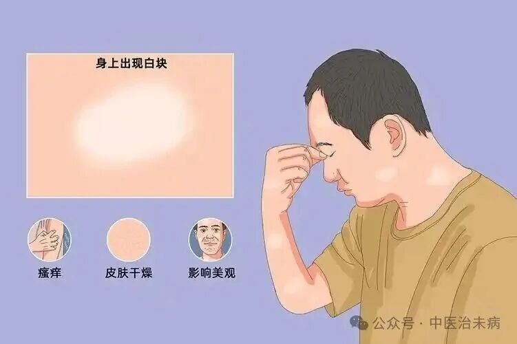 除白散（周鸣岐）