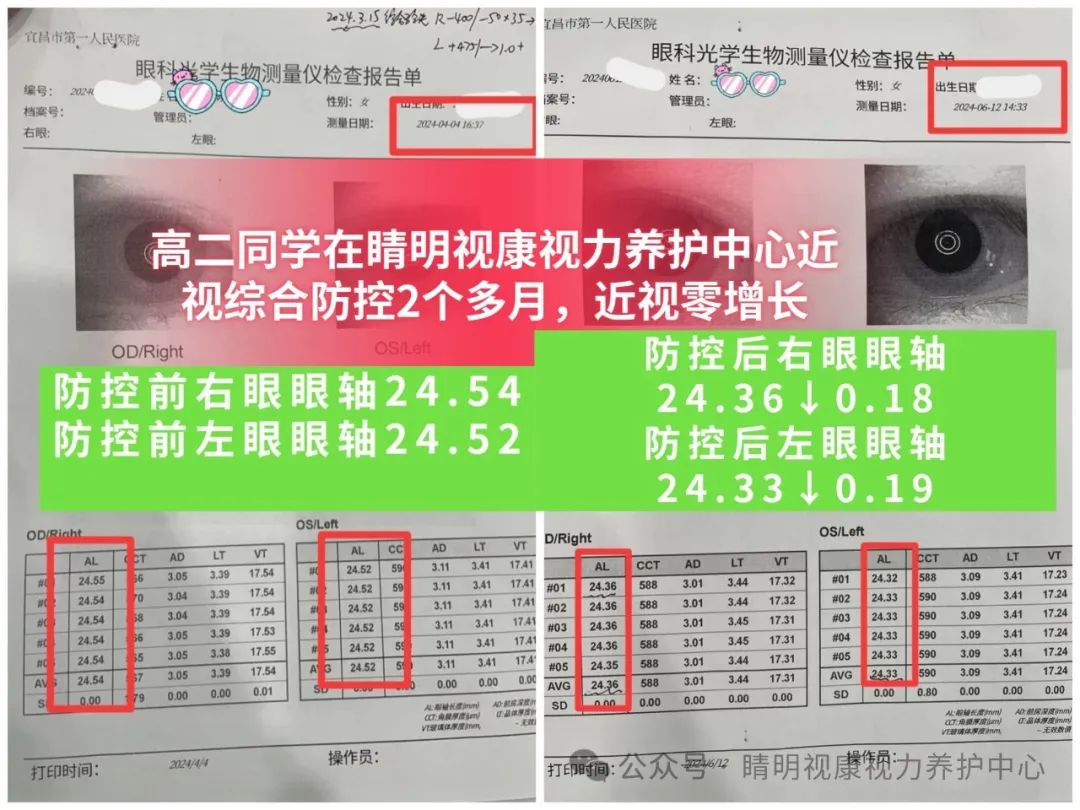 近视500度了有什么办法控制吗？