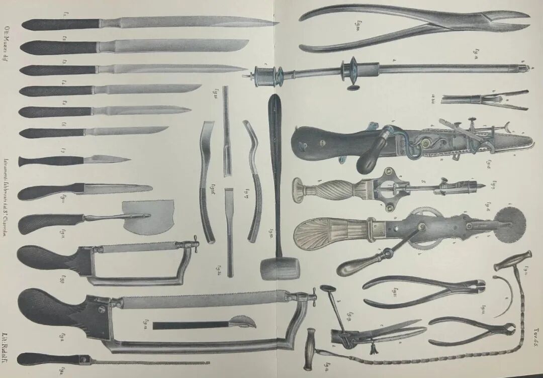 为什么骨科用摆锯电钻、锯子还能用来治病？是的，你没看错！_https://www.jmylbn.com_新闻资讯_第5张