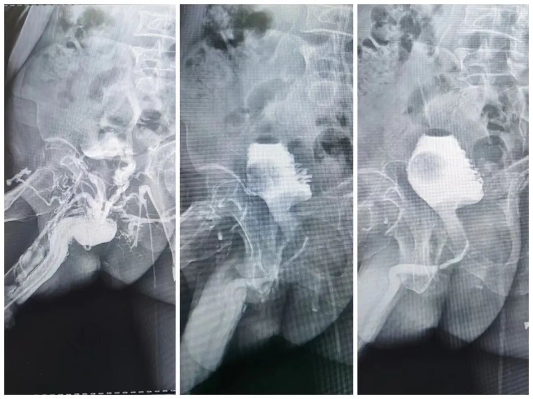数字胃肠透视怎么做【新设备】数字胃肠机——全能型检查小助手_https://www.jmylbn.com_新闻资讯_第11张
