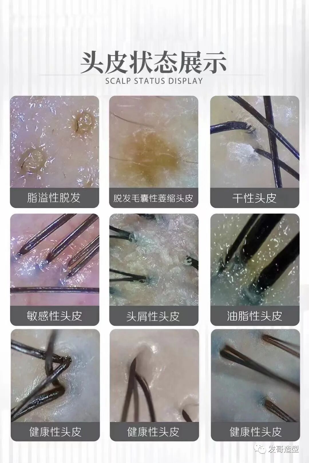 一摸头发感觉头皮痛是怎么回事，怎么办