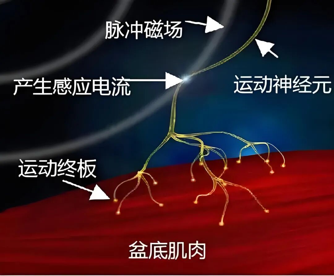 妇科磁疗怎么用的【好消息】盆底健康新起点！大连市中医医院盆底修复中心7月2日正式开诊啦！_https://www.jmylbn.com_新闻资讯_第6张
