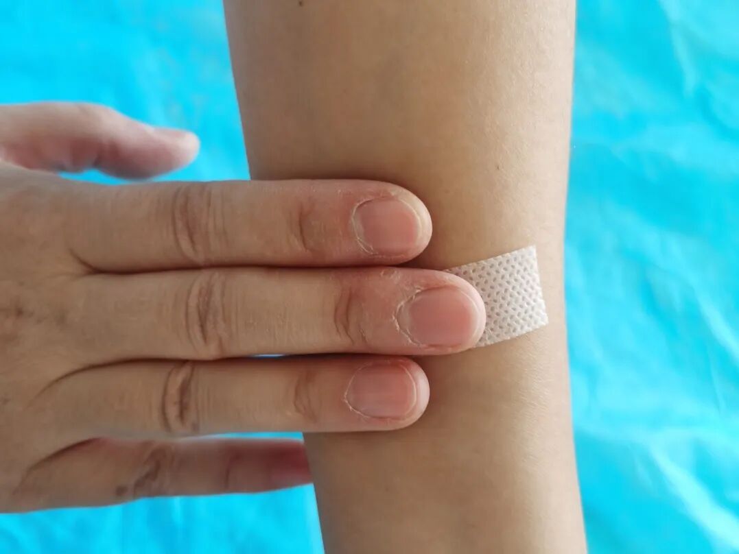 静脉留置针是什么【科普时间】输液时打的“留置针”是什么？_https://www.jmylbn.com_新闻资讯_第8张