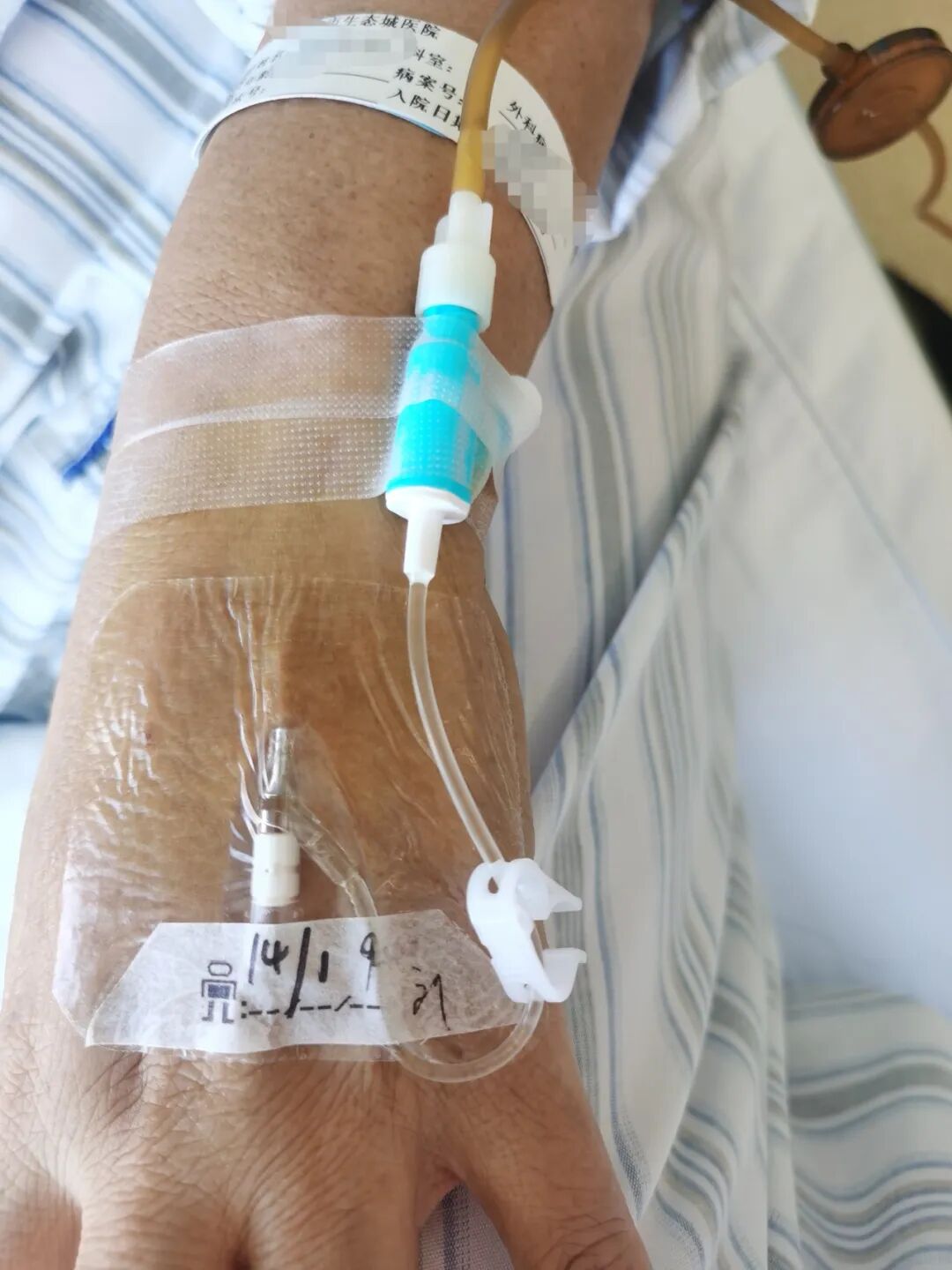 静脉留置针是什么【科普时间】输液时打的“留置针”是什么？_https://www.jmylbn.com_新闻资讯_第6张