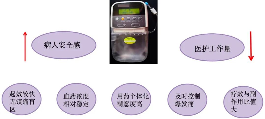 pca泵是什么智能镇痛先锋——全自动自控镇痛泵的临床应用与护理秘诀_https://www.jmylbn.com_新闻资讯_第24张