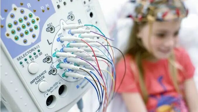 动态脑电图怎么看带您了解动态脑电图_https://www.jmylbn.com_新闻资讯_第8张