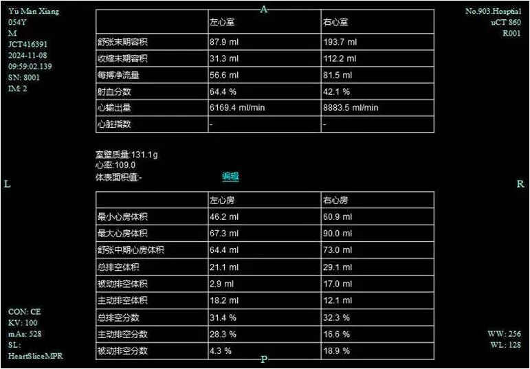联影有哪些CT患者福音，再添利器！第903医院引进联影160排320层UCT天河860高端螺旋CT_https://www.jmylbn.com_新闻资讯_第7张