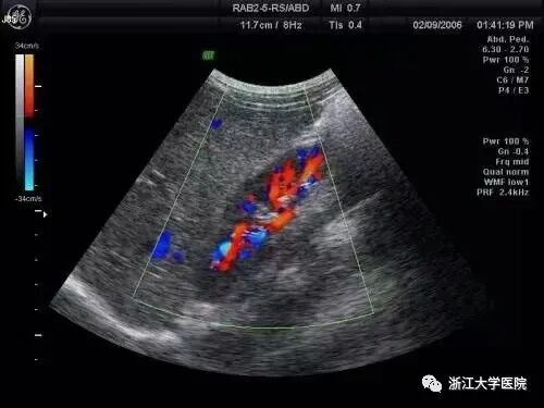 b超md是什么意思叮，一份“B超”检查小常识，请查收_https://www.jmylbn.com_新闻资讯_第3张