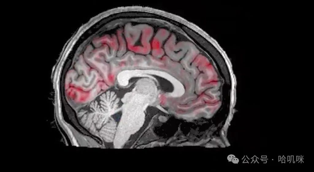 科学家确认熬夜损伤大脑