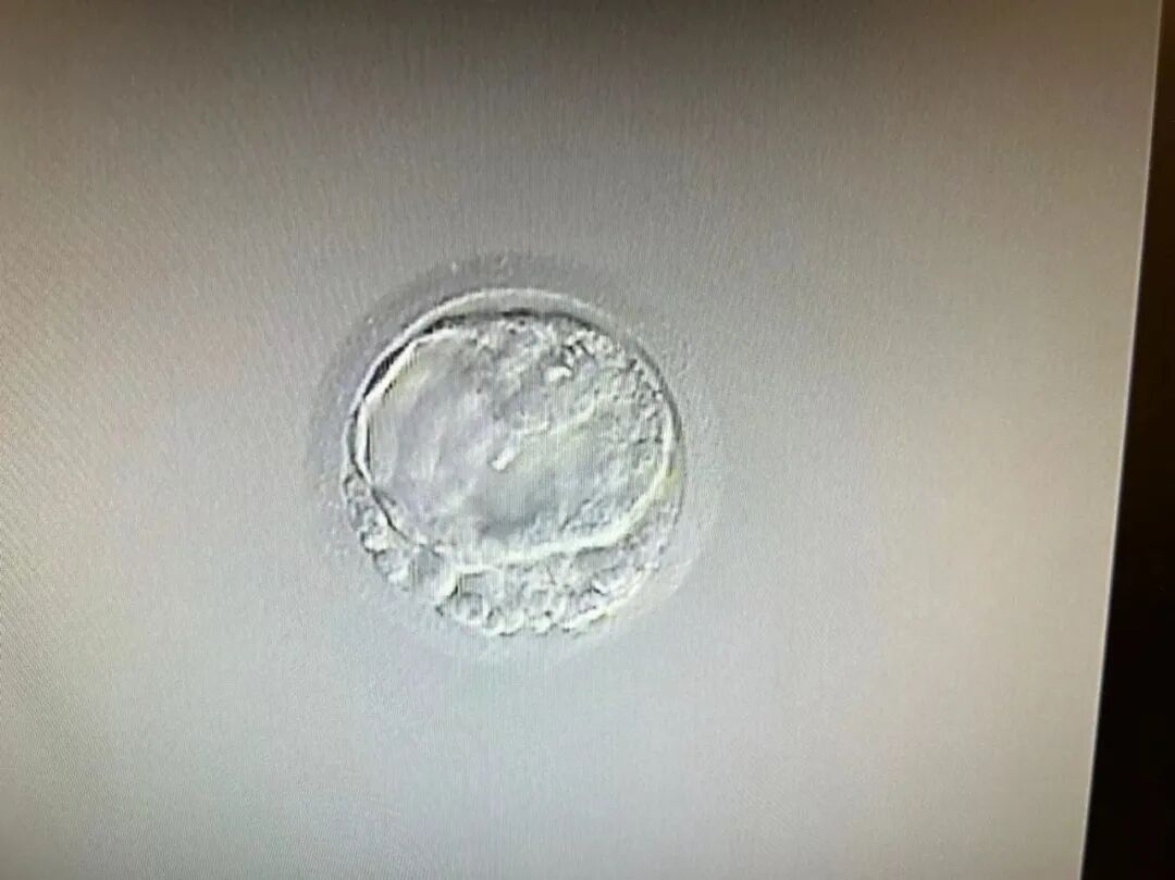 选择比努力重要！试管过程中做好决策，可提高12%活产率