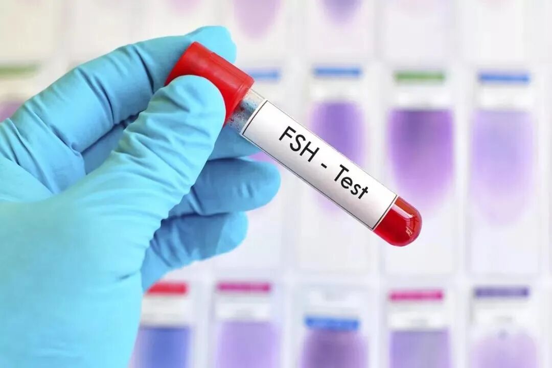 降低FSH就能更快好孕？真的没那么简单