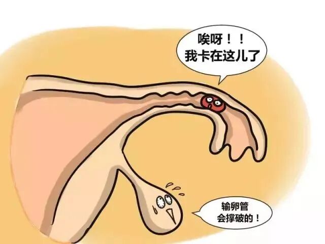 囊胚移植 VS D3胚移植，哪个成功率更高?