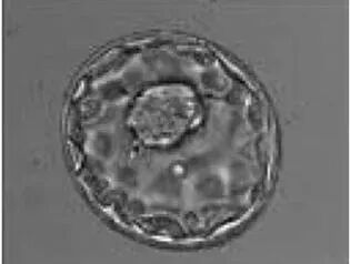 囊胚移植 VS D3胚移植，哪个成功率更高?