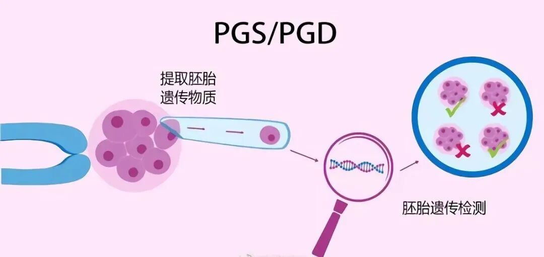 反复着床失败？或许是你忽略了这2个重要原因！