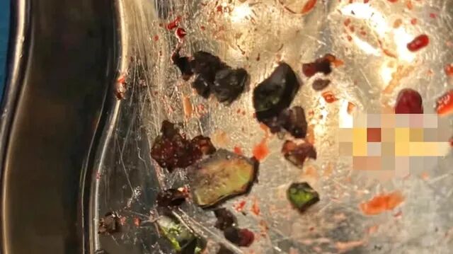 女童往污水道扔鞭炮致1死？不实、为谣言信息