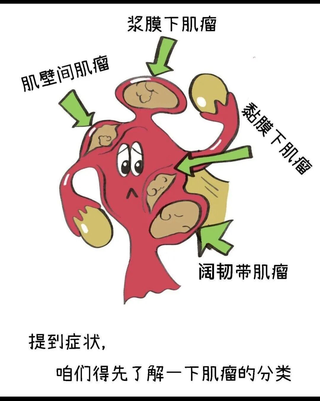 什么是结扎速血管闭合姐妹们，子宫肌瘤是良性肿瘤，不要谈瘤色变_https://www.jmylbn.com_新闻资讯_第5张