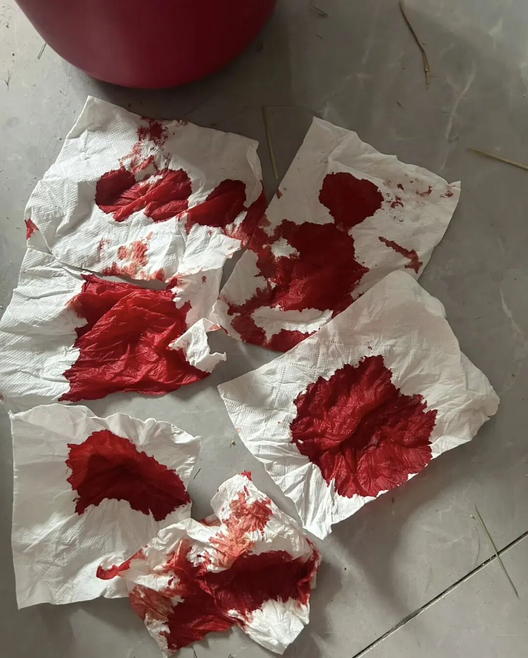 浙江公厕被打女孩确诊白血病