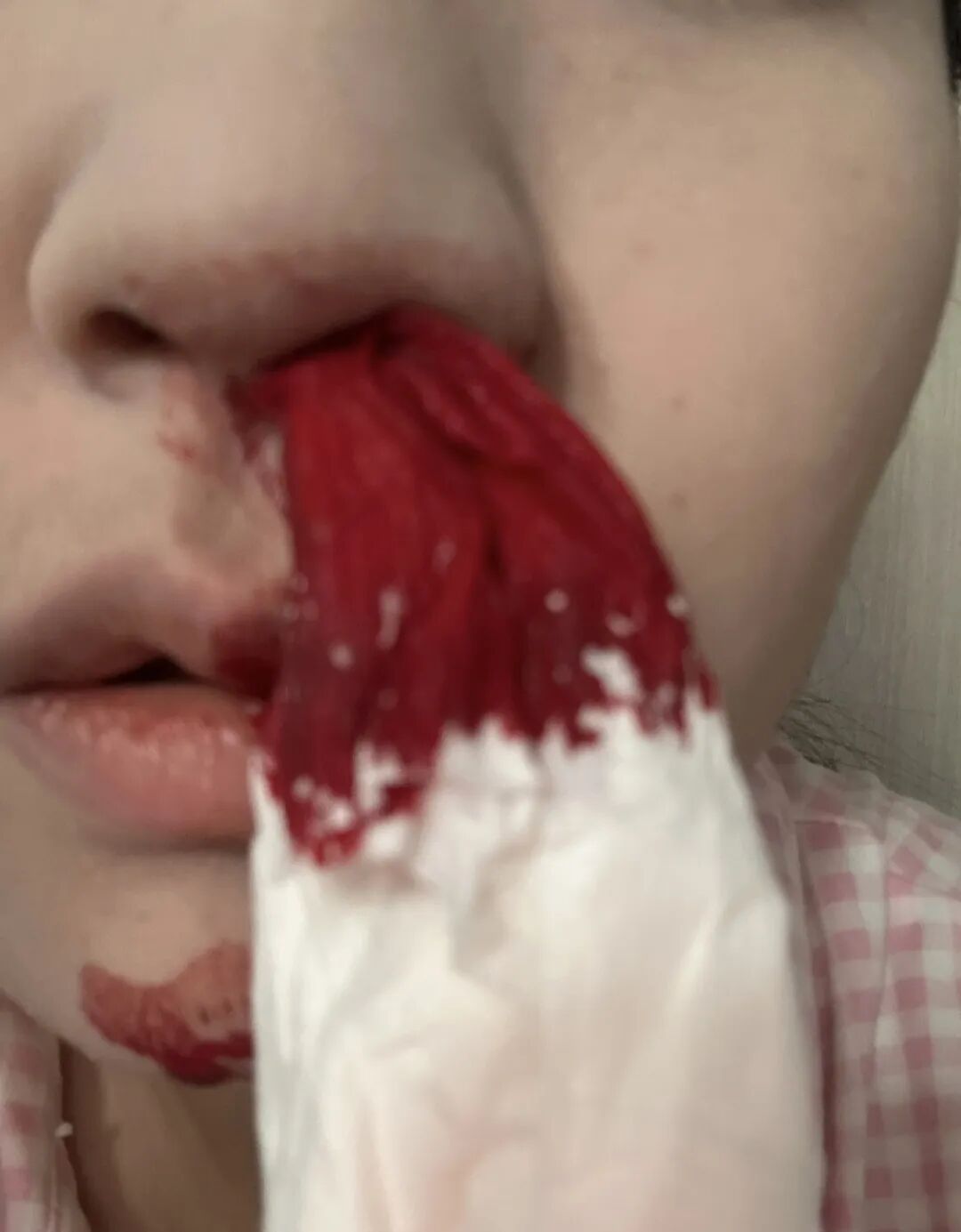 浙江公厕被打女孩确诊白血病