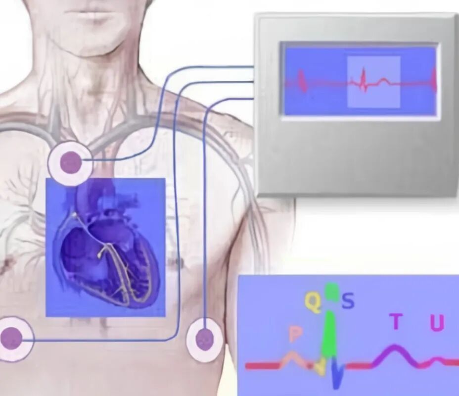 动态心电图仪器怎么看超声诊断与电生理科新开展项目：动态心电图检查_https://www.jmylbn.com_新闻资讯_第3张