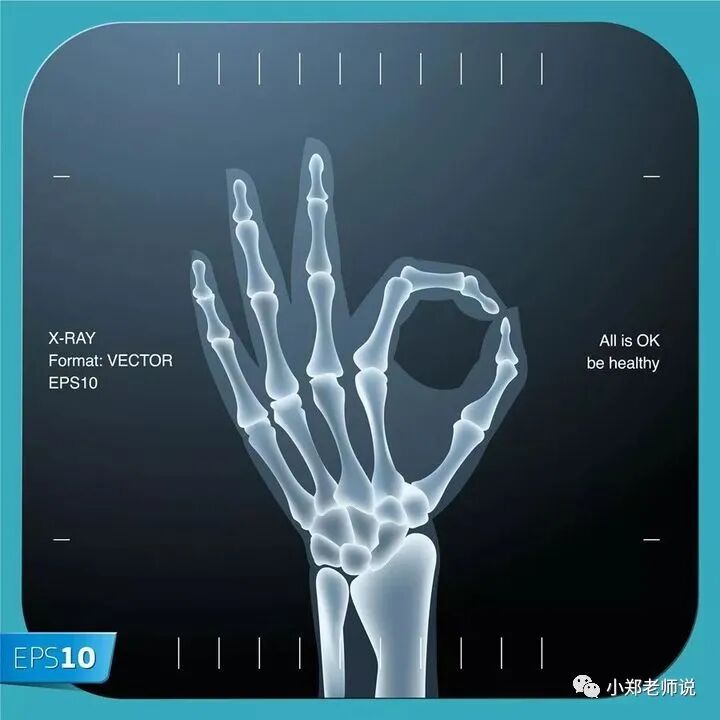 X光拍片为什么要等妈妈要拍片拍X光片做CT，先做好这2点，哺乳安全无忧_https://www.jmylbn.com_新闻资讯_第11张