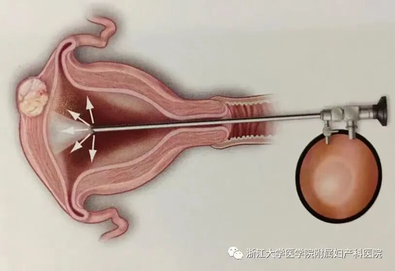 气管插管纱布怎么垫急诊仅0.4%？梅奥专家揭秘：清醒插管85%成功率的救命法则！(附详细图解)_https://www.jmylbn.com_新闻资讯_第24张