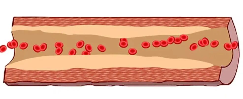 彩色经颅多普勒是什么【广医保定｜健康科普·功能检查科】带你认识经颅多普勒超声检查_https://www.jmylbn.com_新闻资讯_第7张