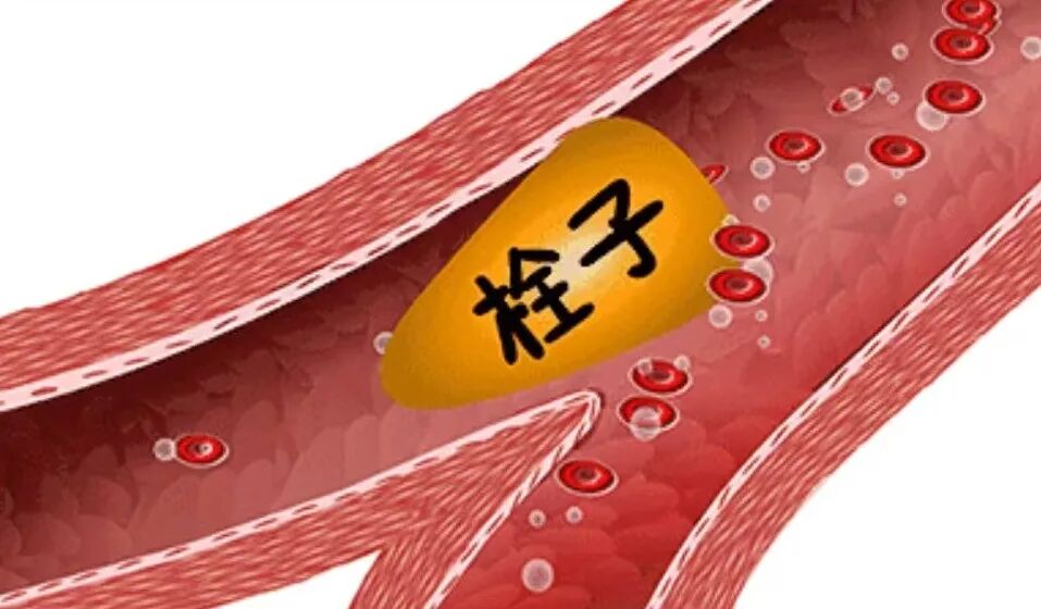 彩色经颅多普勒是什么【广医保定｜健康科普·功能检查科】带你认识经颅多普勒超声检查_https://www.jmylbn.com_新闻资讯_第8张