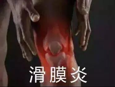 滑膜炎？老中医教你一秘方，在家就能做，用得好，积液肿胀全消失