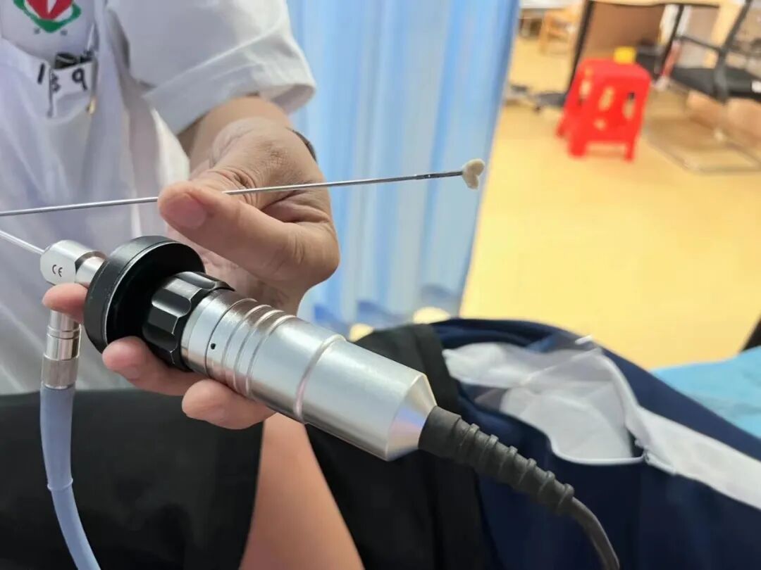 耳鼻喉内镜是什么科【医疗动态】五官科的“火眼金睛”——内窥镜检查_https://www.jmylbn.com_新闻资讯_第14张