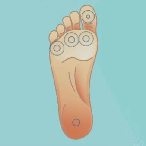 为什么糖尿病不能震动血糖高了，脚会遭殃？关注双脚，远离糖尿病足｜健康之路_https://www.jmylbn.com_新闻资讯_第6张