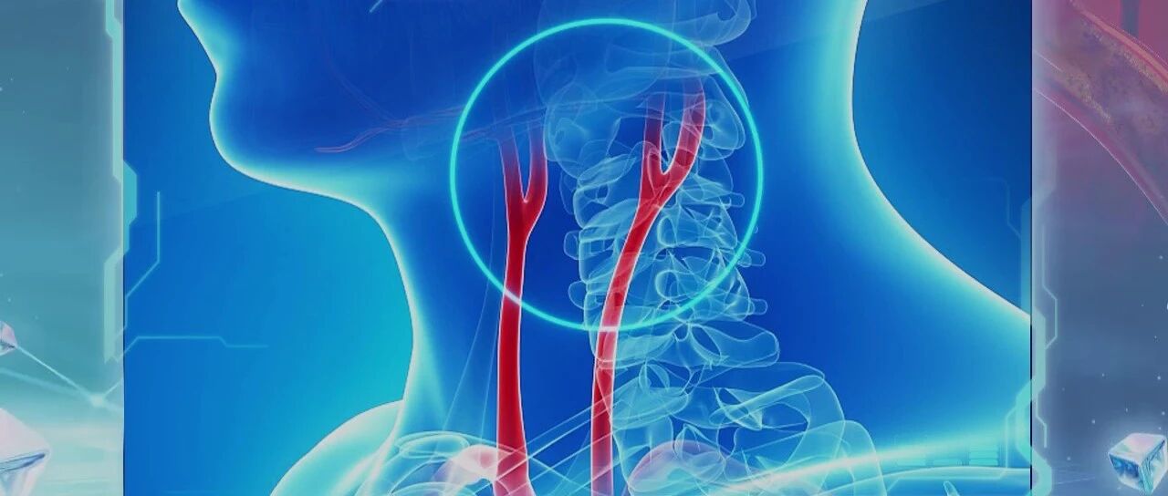 一过性黑蒙、突然失语、突然偏瘫，这是颈动脉在报警！｜健康之路