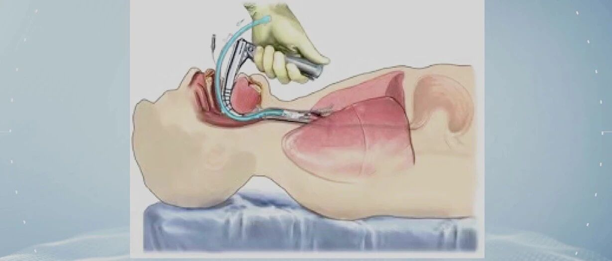 手术全程中，麻醉医生在悄悄为您做什么？｜健康之路