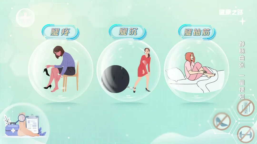 弹力腰围怎么用自测静脉曲张风险，再不重视就晚了！｜健康之路_https://www.jmylbn.com_新闻资讯_第4张