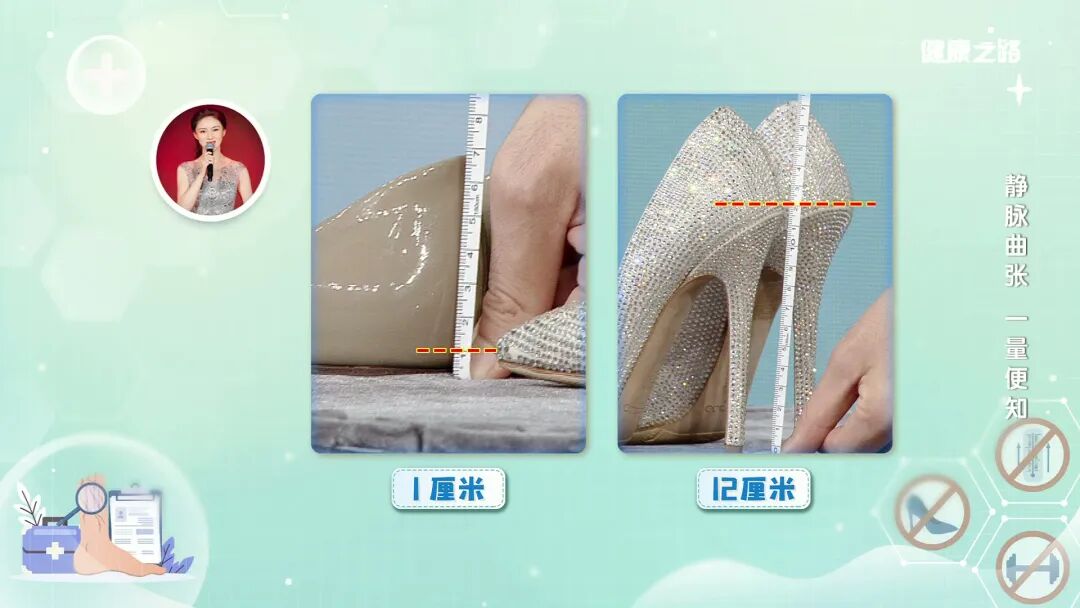 弹力腰围怎么用自测静脉曲张风险，再不重视就晚了！｜健康之路_https://www.jmylbn.com_新闻资讯_第5张