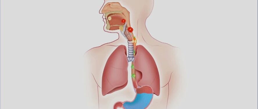 爱打岔、嗓子不舒服、常头晕，背后的原因竟然是……｜健康之路