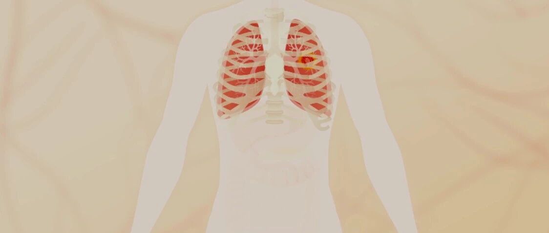 不要让隐匿的肺部疾病，夺去你的生命！｜健康之路