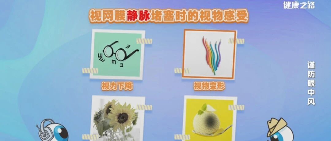 你有得眼中风的风险吗？做完这4个测试，答案已然揭晓！| 健康之路