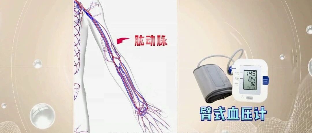 家中常备血压计？但量了这么多年，您量得对吗？|健康之路