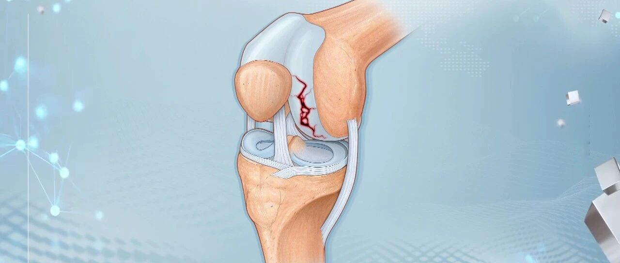 伤膝盖的事儿，您可能每天都在做！请记住这三条忠告｜健康之路