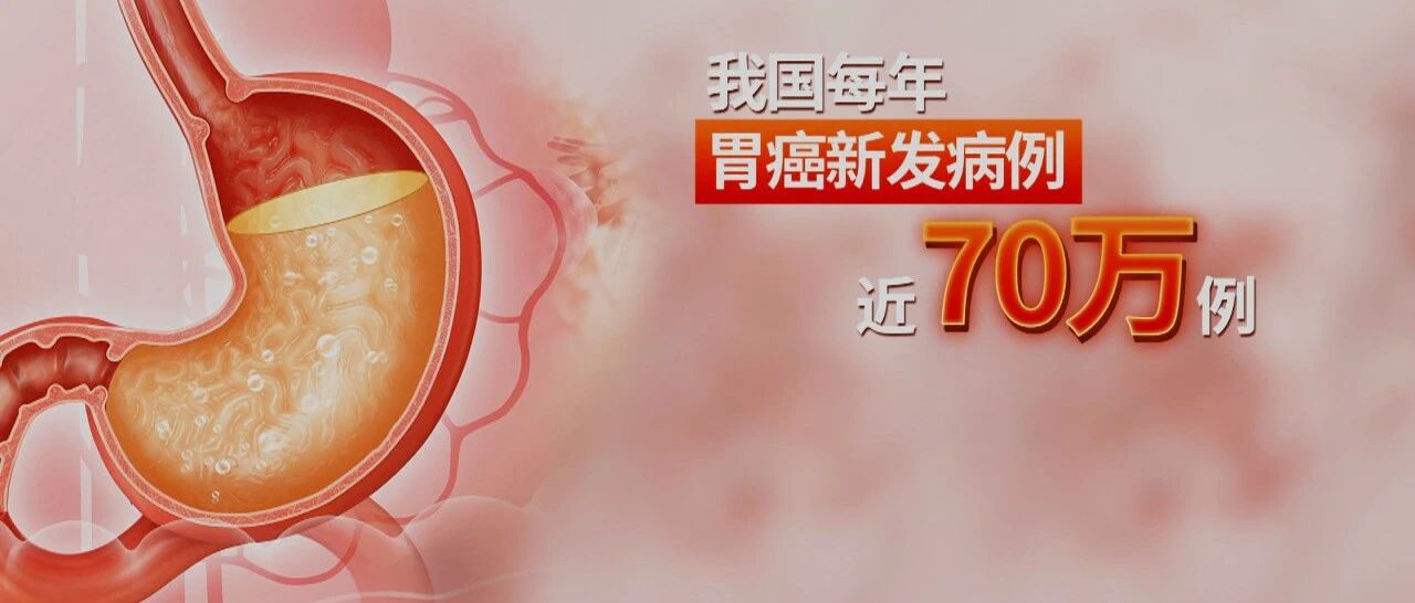 这六类人群，胃镜检查赶紧约起来！｜健康之路