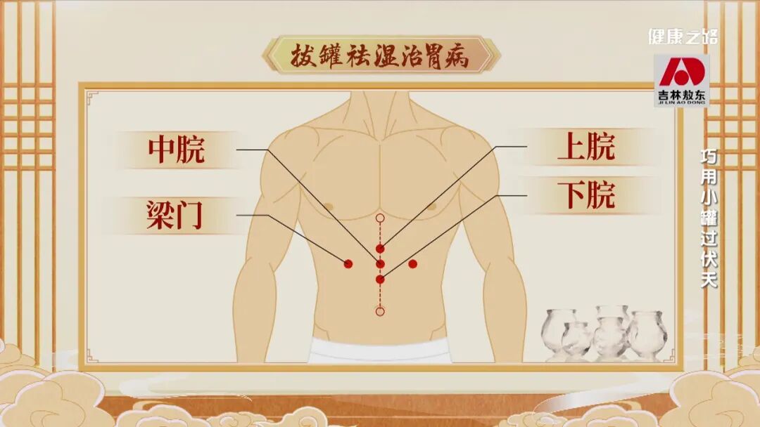 三伏天拔罐有哪些好处?看完就知道了|健康之路-友友